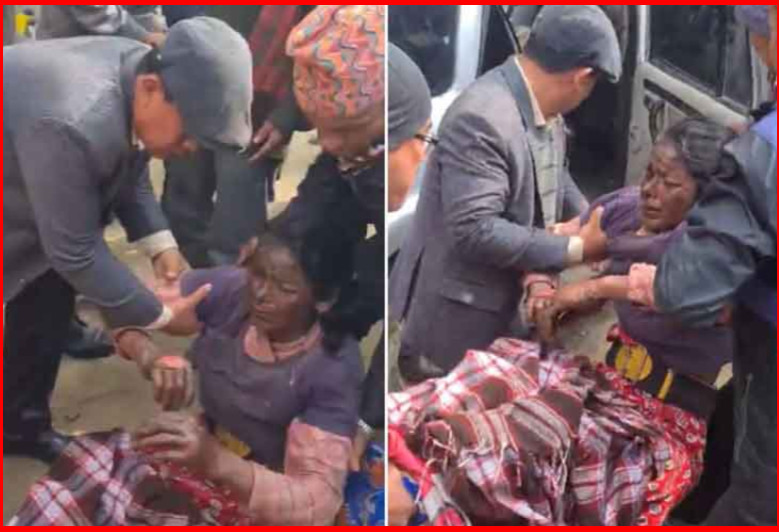 आगोको लप्कामा परेकी मैयालाई गाउँपालिका अध्यक्ष भुपेन्द्र राईले गरे उद्धार (भिडिओ सहित)