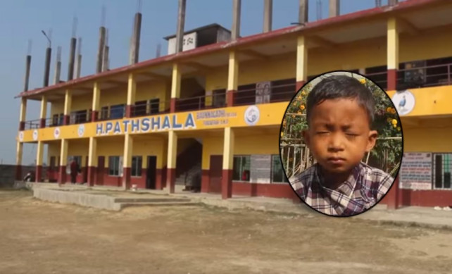 शिक्षिकाको कुटाइबाट विद्यार्थीको आँखा फुट्यो, अस्पतालले भन्यो -आँखा सधैंका लागि गुम्यो